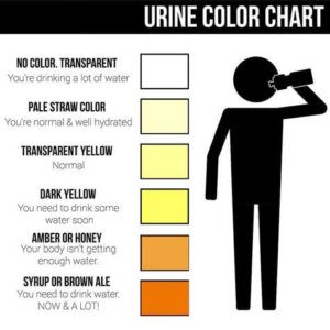 urine color h