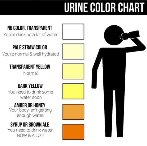 urine color h