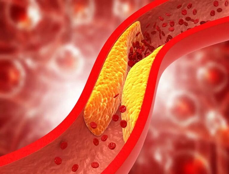 7 Ways to Control Cholesterol Levels | Cholesterol Diet