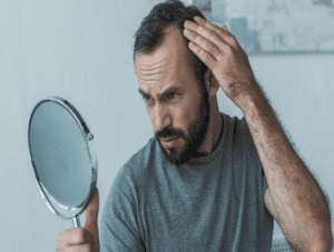 Male's Pattern Baldness Treatment | How to Get Rid From Hair Loss